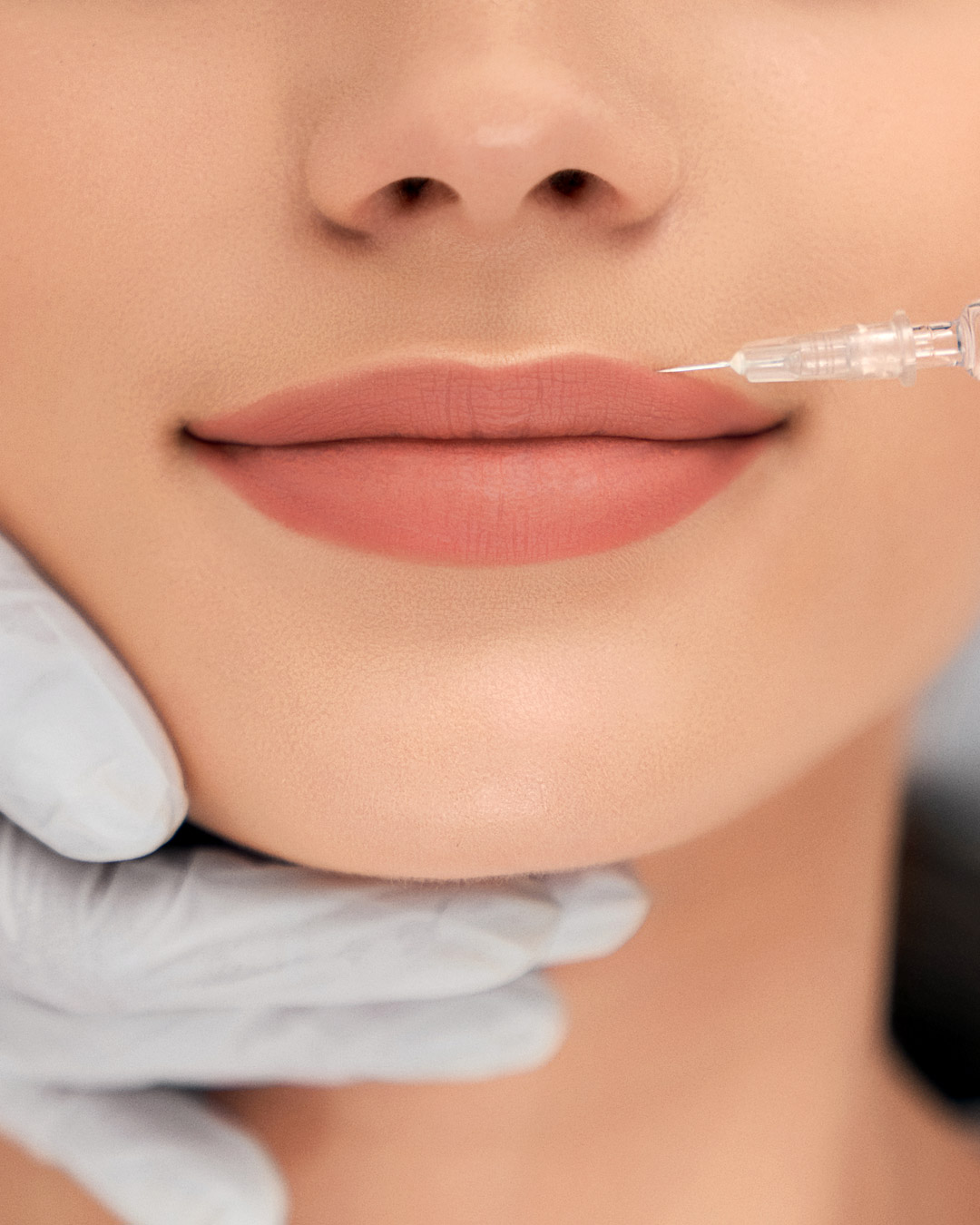 Medicina Estética Hidratación y aumento de labios - EVO Beauty Clinics