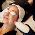 Tratamiento Facial IPL by Stellar M-22 - EVO Beauty Clinics