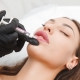 Aumento de labios: Tratamientos con resultados naturales