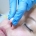 elevador nasal