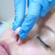 elevador nasal