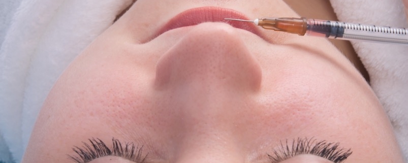 aumento de labios muy finos