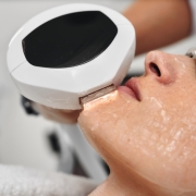 fotorejuvenecimiento facial