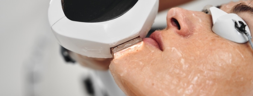 fotorejuvenecimiento facial