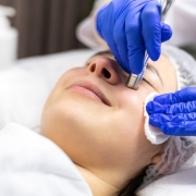 microdermoabrasión cara