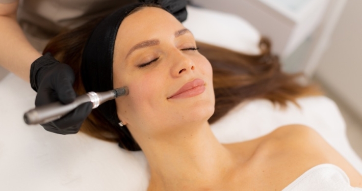 facial microneedling