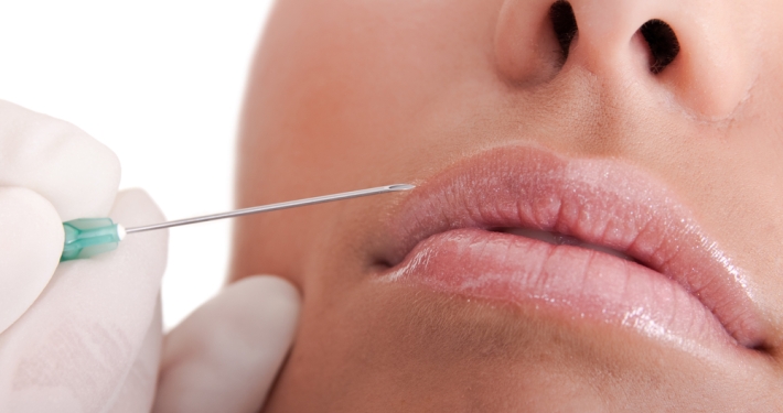 aumento de labios permanente