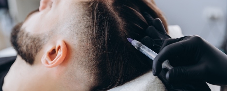 inyecciones para el pelo