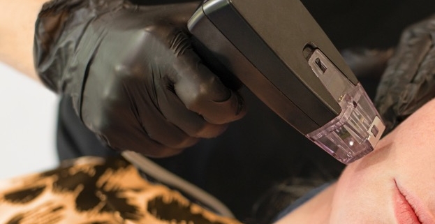 tratamiento morpheus