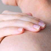 recomendaciones para una piel deshidratada