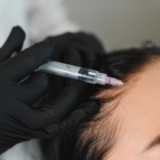 cuanto cuesta un tratamiento de mesoterapia capilar