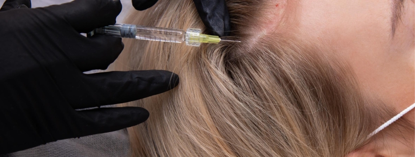 Tratamiento botox capilar: suavidad, volumen y brillo