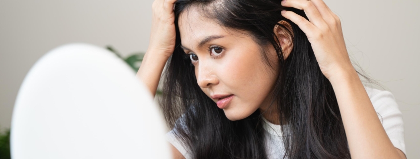 Productos naturales para frenar la caída del cabello