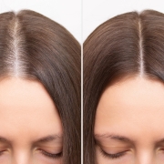 ¿Quieres el mejor tratamiento para la caída del cabello en la mujer?