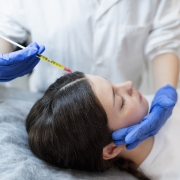 que es la mesoterapia capilar