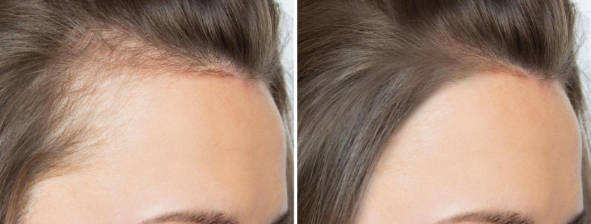 cómo fortalecer el cabello