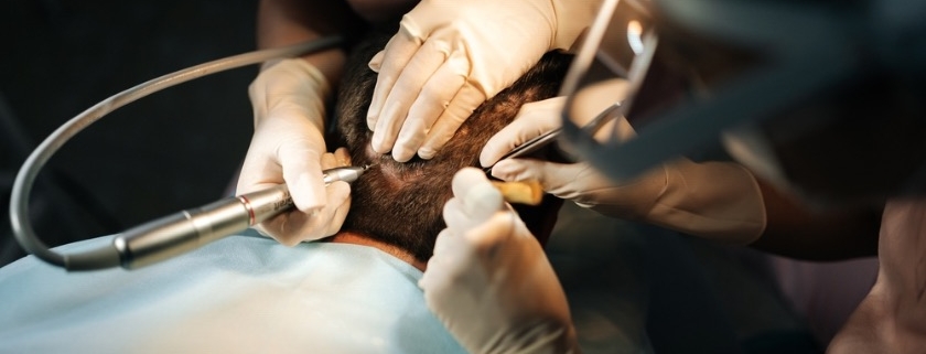 tratamiento para el pelo