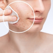 principios activos para piel grasa deshidratada