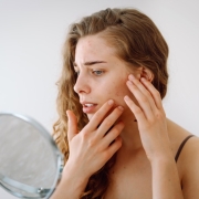 cómo quitar manchas de la piel