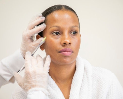 botox patas de gallo