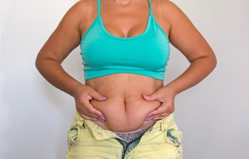 tratamientos para eliminar grasa localizada sin cirugía