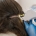 mesoterapia capilar efectos secundarios