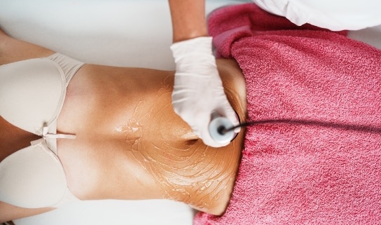 remodelación corporal